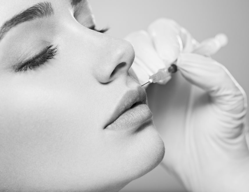 Injections d'Acide Hyaluronique lèvres - à Suresnes | CLEM, médecine esthétique