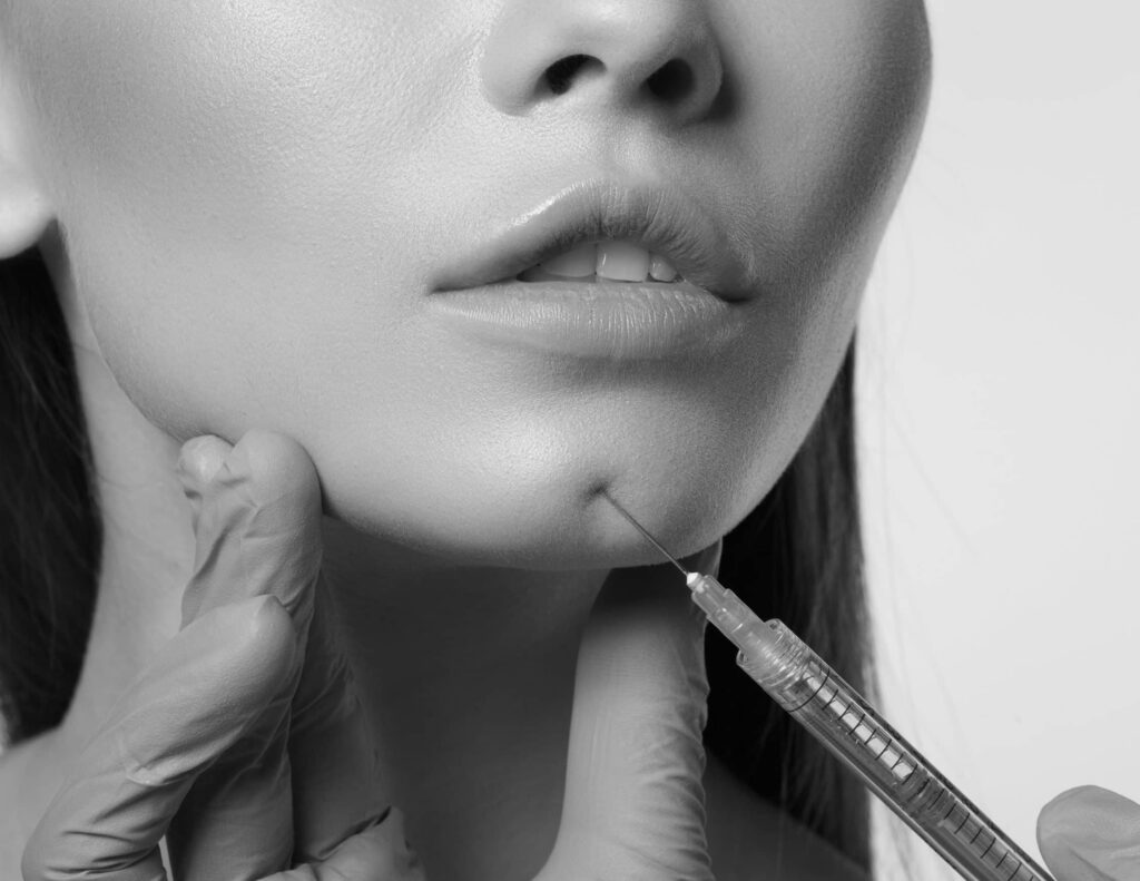 Acide Hyaluronique Menton - à Suresnes - Tarif | CLEM, médecine esthétique