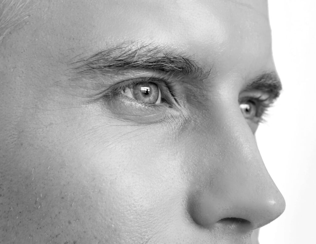 Epilation laser nez, CLEM, Suresnes