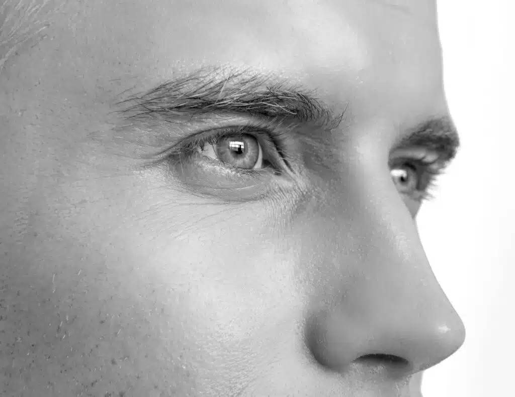 Epilation laser nez, CLEM, Suresnes