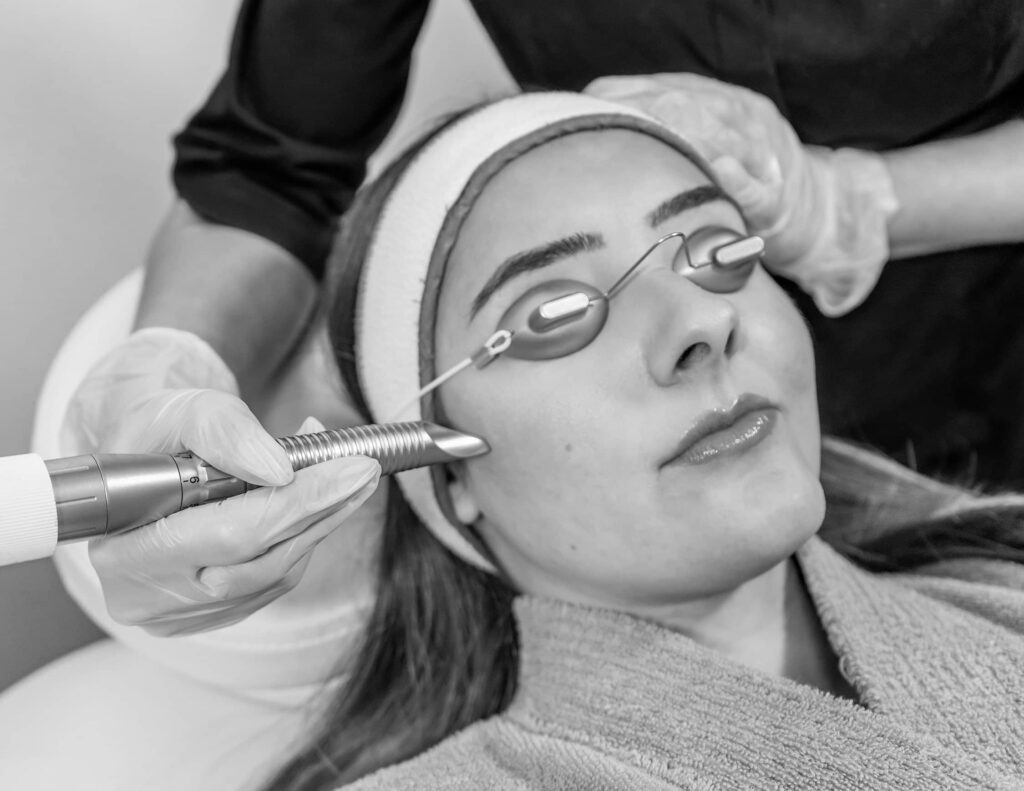 Peeling Resurfacing, à Suresnes - Résultats & Tarifs | CLEM, Centre Esthétique