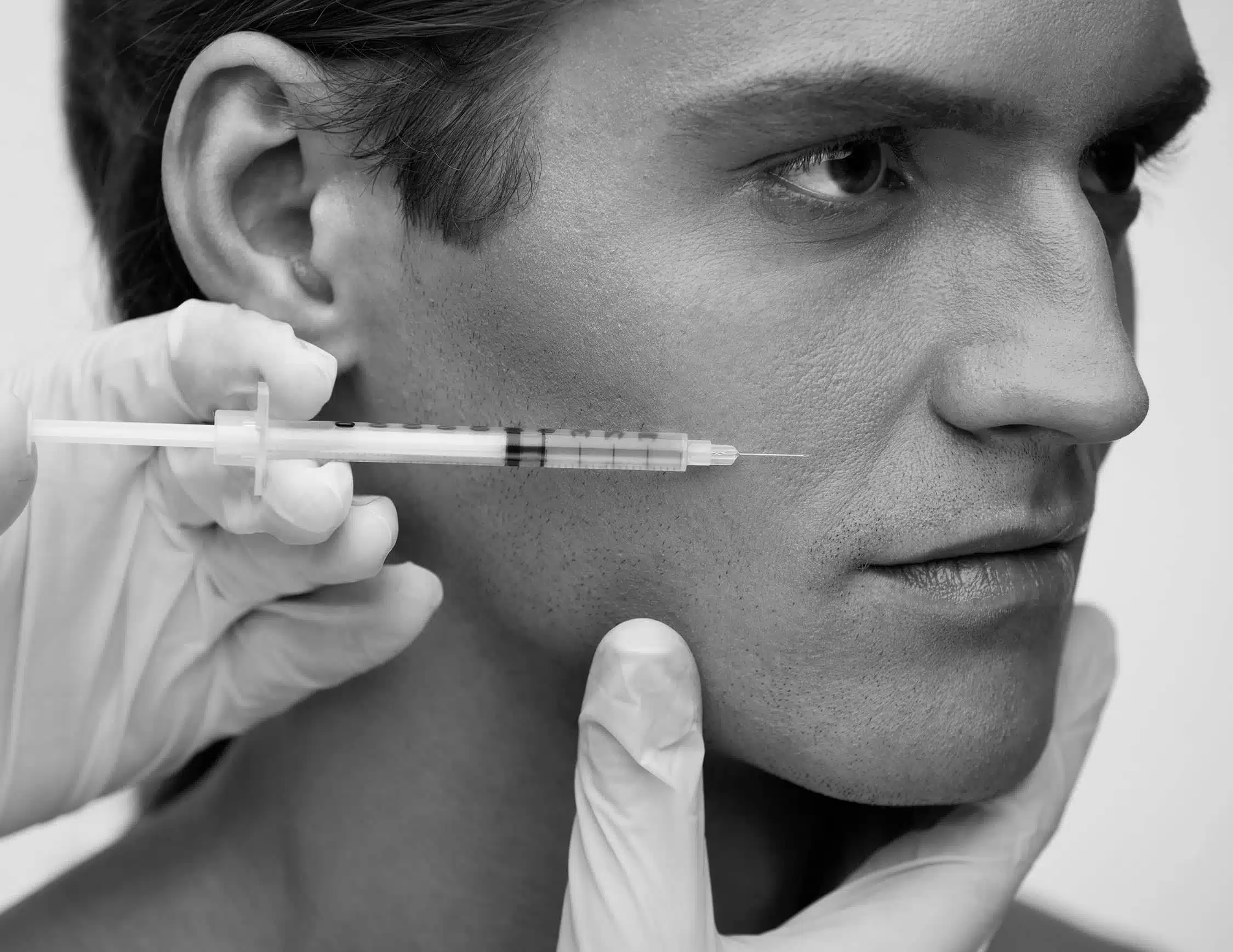 Les injection d'acide hyaluronique contre les rides, chez CLEM - Suresnes