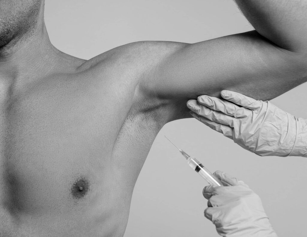 Injection de Botox Aisselles, à Suresnes - Transpiration | CLEM, Centre Esthétique