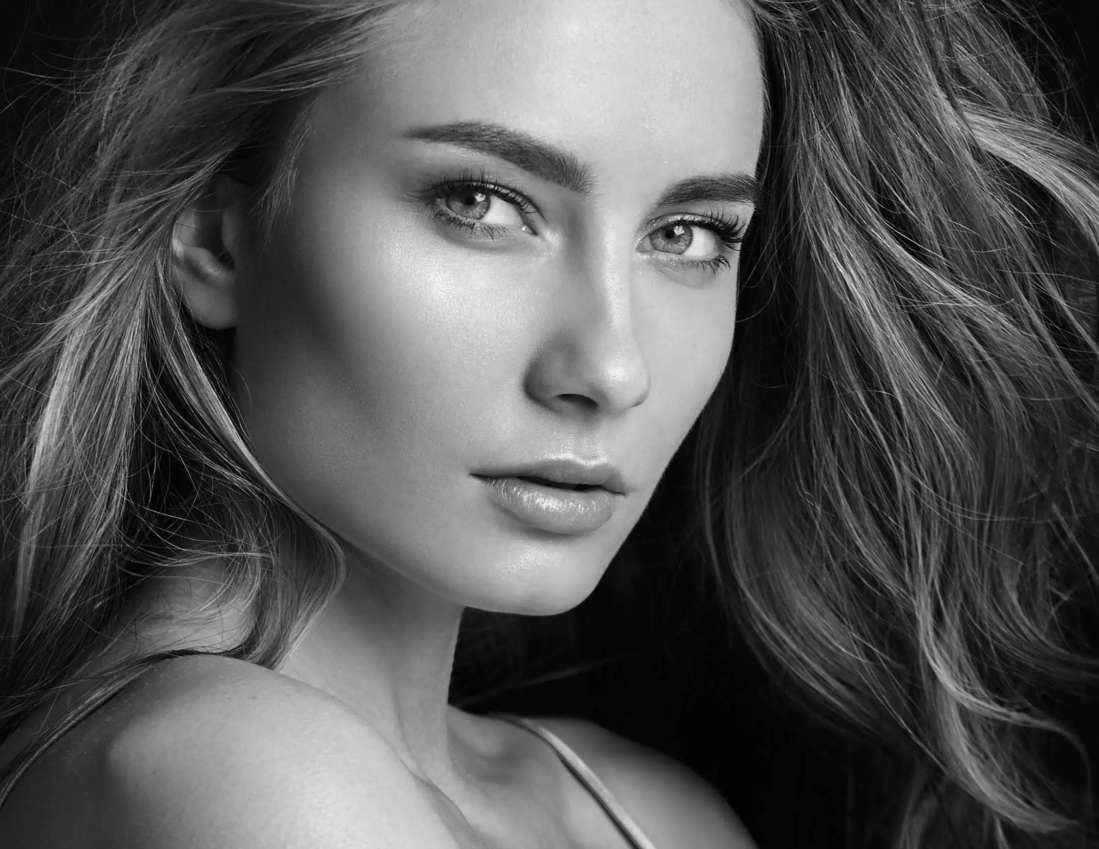 Injections de Botox, à Suresnes - Rides & Hyperhidrose | CLEM, Centre Esthétique