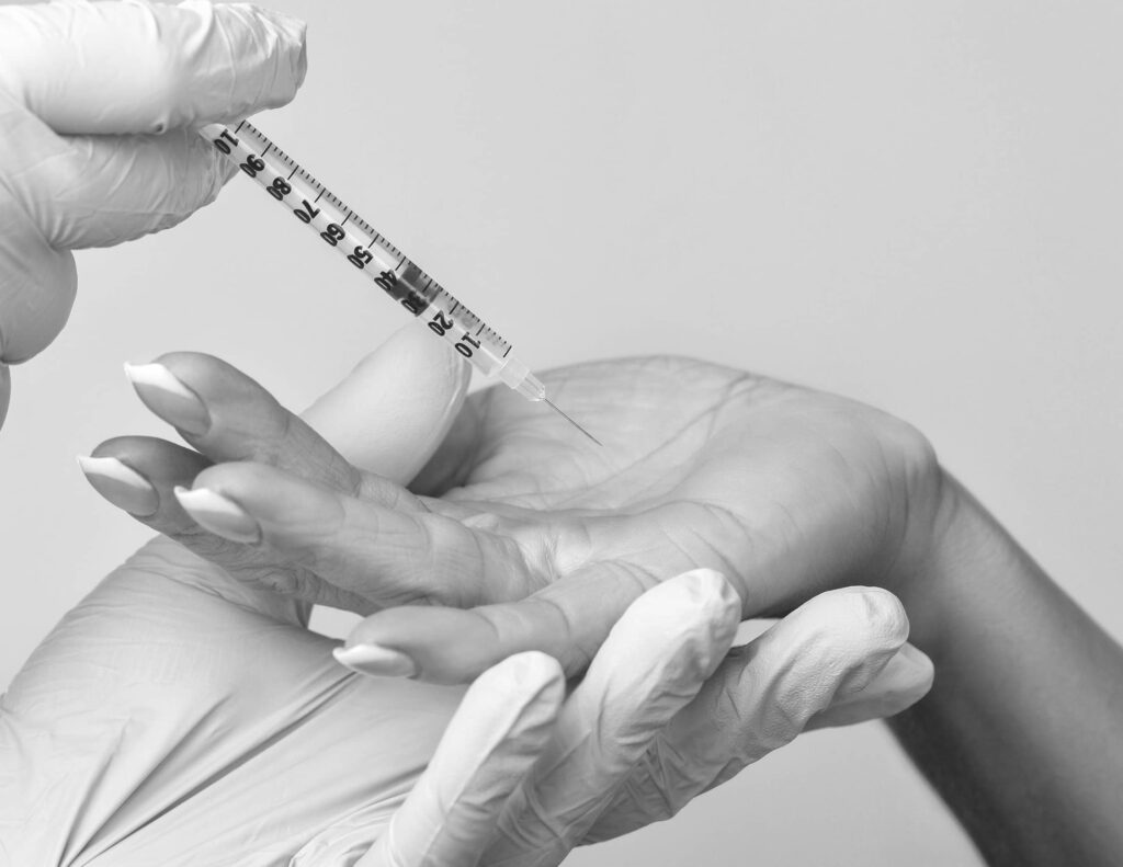 Transpiration Excessive des Mains, à Suresnes - Botox | CLEM, Centre Esthétique