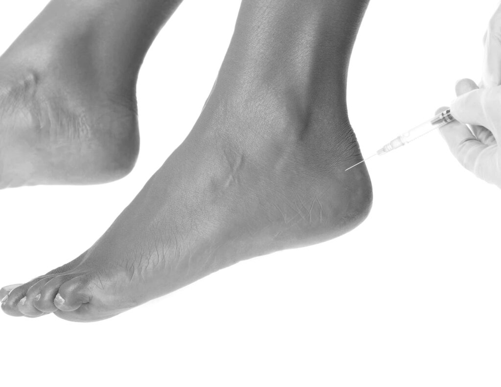 Loub Job, à Suresnes - Acide Hyaluronique Pieds - Tarif | CLEM, Centre Esthétique