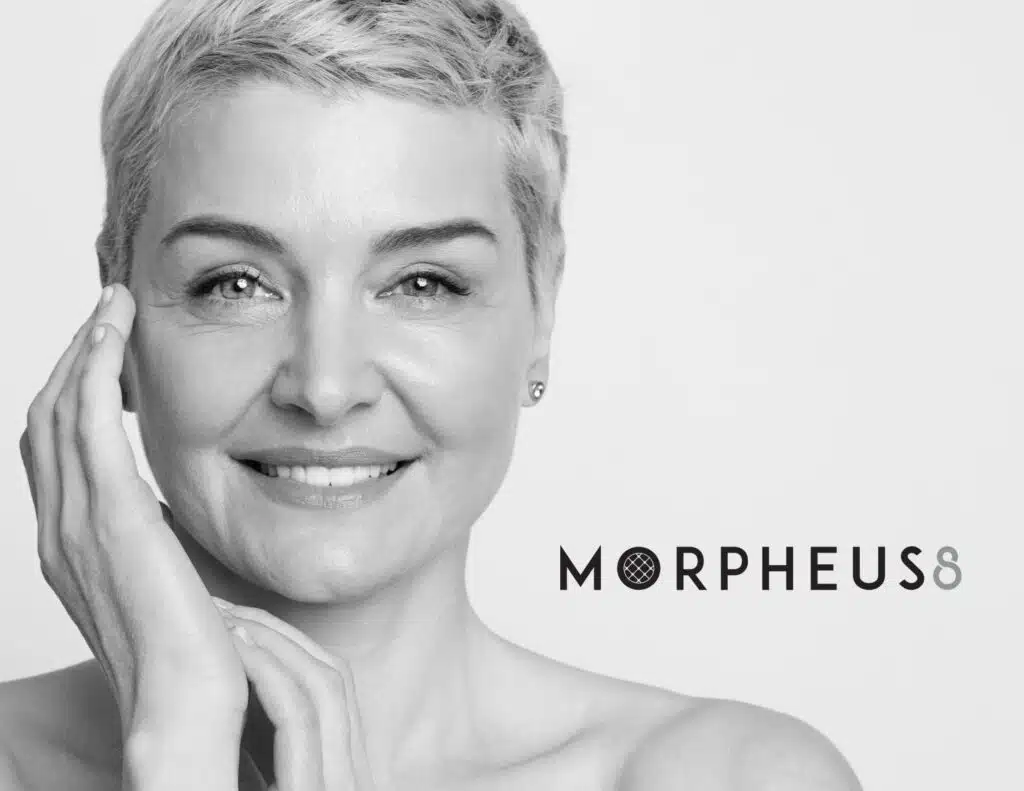 jolie visae d’une femme suite à un traitement Morpheus8 proche de Paris au centre Clem