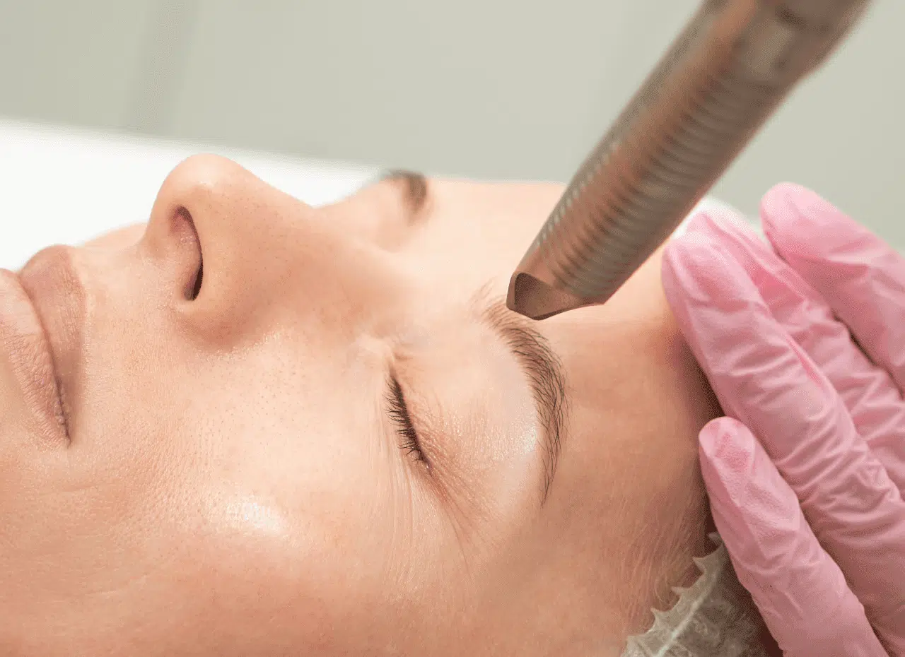 relachement-cutane-traitement-fotona-4d-centre-clem-suresnes