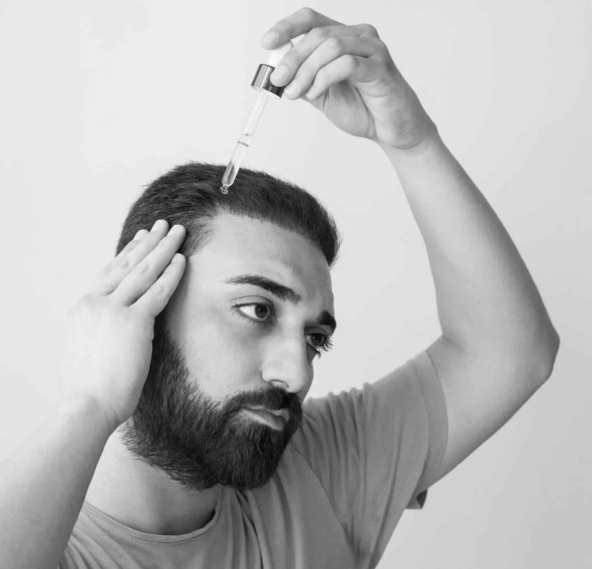 Quelles sont les précautions à prendre après une greffe de cheveux ? | CLEM | Suresnes